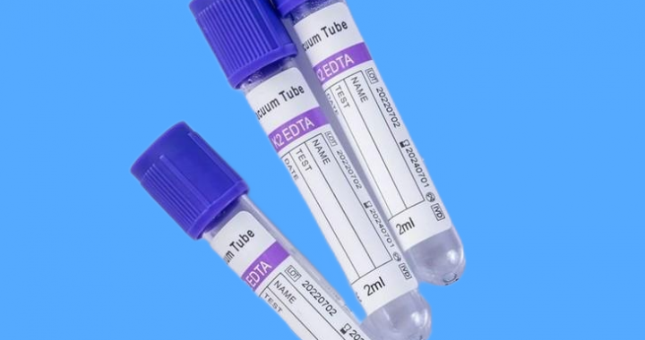 2~10ml K2 EDTA Vacuum Blood Tube