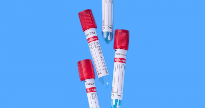Vacuum Blood Tube Blue Cap Coggulation